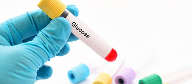 Chẩn đoán bệnh thông qua chỉ sô Glucose huyết tương.