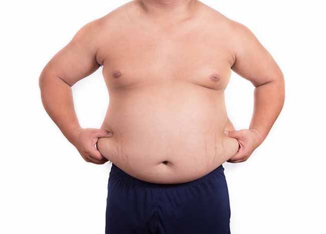 Yếu tố béo phì là nguyên nhân chặt chẽ gây ra kháng Insulin. 