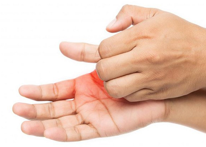 Ngứa tay và chân cũng có thể là dấu hiệu của bệnh vẩy nến
