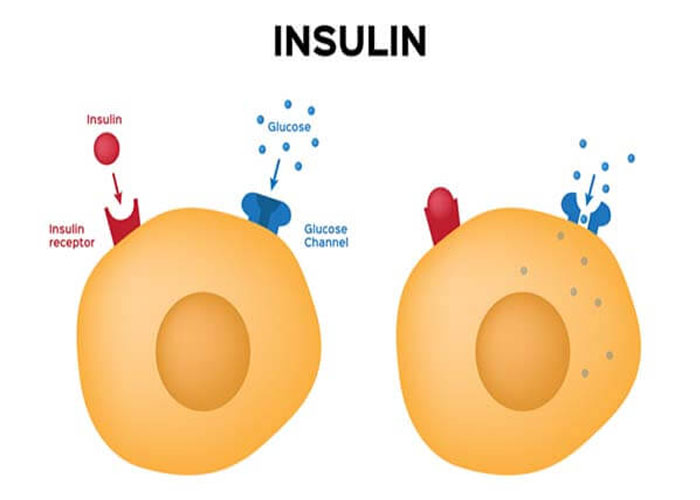 Tiểu đường tuýp 1 là tình trạng thiếu insulin